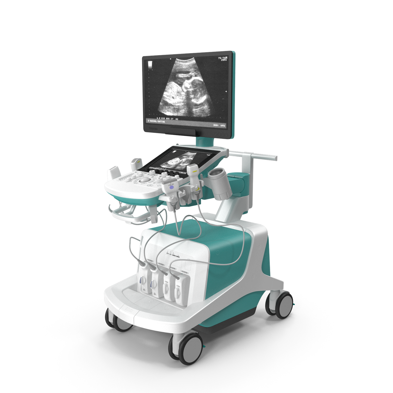 Ultrasound Scanner System Generic.H03.2k